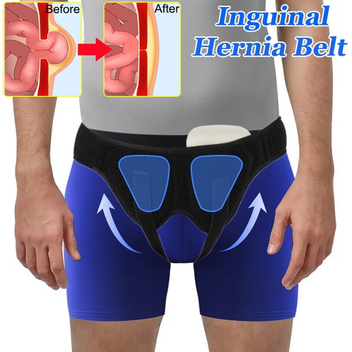 Inguinal hernia belt for - inguinal,